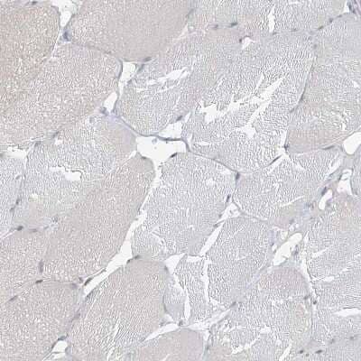 Immunohistochemistry-Paraffin: MCPIP1/ZC3H12A Antibody [NBP2-37871] - Staining of human skeletal muscle shows no positivity in myocytes as expected.