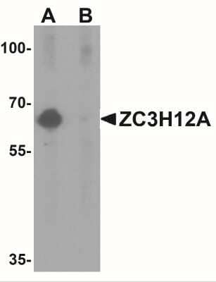 Western Blot: MCPIP1/ZC3H12A Antibody [NBP1-76258] - Western blot analysis of ZC3H12A in K562 cell lysate with ZC3H12A antibody at 1 ug/mL in (A) the absence and (B) the presence of blocking peptide.