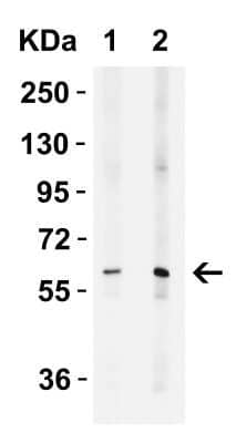 Western Blot: MCPIP1/ZC3H12A Antibody [NBP3-18333] - WB Validation in Human Lung. Loading: 15 ug of lysate per lane. Antibodies: MCPIP1/ZC3H12A NBP3-18333, 1 h incubation at RT in 5% NFDM/TBST. Secondary: Goat Anti-Rabbit IgG HRP conjugate at 1:10,000 dilution. Lane 1: 2 ug/mL Lane 2: 4 ug/mL