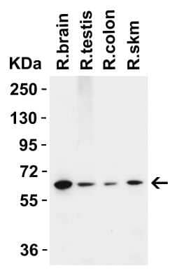 Western Blot: MCPIP1/ZC3H12A Antibody [NBP3-18333] - Western Blot Validation in Rat Tissues. Loading: 15 ug of lysates per lane. Antibodies: MCPIP1/ZC3H12A NBP3-18333, 2 ug/mL, 1h incubation at RT in 5% NFDM/TBST. Secondary: Goat anti-rabbit IgG HRP conjugate at 1:10,000 dilution.