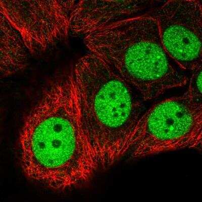 Immunocytochemistry/Immunofluorescence: MCRS1 Antibody [NBP1-81615] - Staining of human cell line MCF7 shows localization to nucleoplasm. Antibody staining is shown in green.