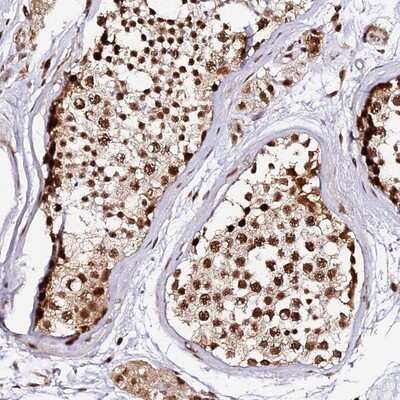 Immunohistochemistry-Paraffin: MCRS1 Antibody [NBP1-81615] - Staining of human testis shows strong nuclear positivity in cells in seminiferus ducts.