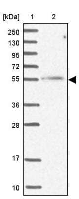 Western Blot: MCRS1 Antibody [NBP1-81615] - Lane 1: Marker  [kDa] 250, 130, 95, 72, 55, 36, 28, 17, 10.  Lane 2: Human cell line RT-4