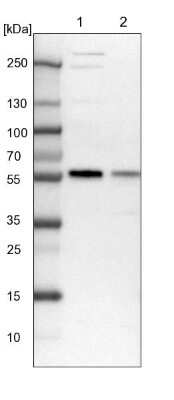 Western Blot: MCRS1 Antibody [NBP1-81615] - Lane 1: NIH-3T3 cell lysate (Mouse embryonic fibroblast cells). Lane 2: NBT-II cell lysate (Rat Wistar bladder tumor cells).