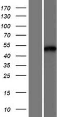 Western Blot: MCRS1 Overexpression Lysate (Adult Normal) [NBP2-07638] Left-Empty vector transfected control cell lysate (HEK293 cell lysate); Right -Over-expression Lysate for MCRS1.