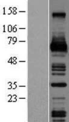 Western Blot: MCSF Overexpression Lysate (Adult Normal) [NBL1-09513] Left-Empty vector transfected control cell lysate (HEK293 cell lysate); Right -Over-expression Lysate for MCSF.