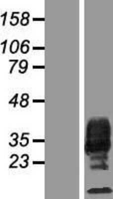 Western Blot: MCSF Overexpression Lysate (Adult Normal) [NBP2-05168] Left-Empty vector transfected control cell lysate (HEK293 cell lysate); Right -Over-expression Lysate for MCSF.