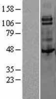 Western Blot: MCSF Receptor Overexpression Lysate (Adult Normal) [NBL1-09514] Left-Empty vector transfected control cell lysate (HEK293 cell lysate); Right -Over-expression Lysate for MCSF Receptor.