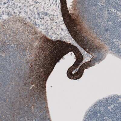 Immunohistochemistry-Paraffin: MCT8/SLC16A2 Antibody [NBP1-89196] - Staining of mouse circumventricular organs shows moderate to strong membranous positivity.