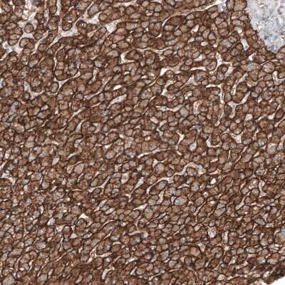 Immunohistochemistry-Paraffin: MCT8/SLC16A2 Antibody [NBP1-89196] - Staining of human liver shows moderate to strong membranous positivity in hepatocytes.