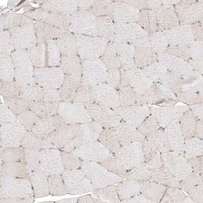 Immunohistochemistry-Paraffin: MCT8/SLC16A2 Antibody [NBP1-89196] - Staining of human skeletal muscle shows weak positivity in striated muscle fibers.