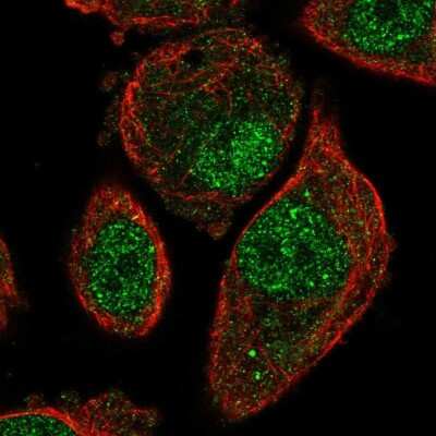 Immunocytochemistry/Immunofluorescence: MCTP1 Antibody [NBP1-83604] - Immunofluorescent staining of human cell line PC-3 shows localization to nucleoplasm & cytosol.