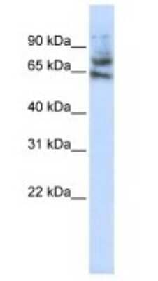 Western Blot: MCTP1 Antibody [NBP1-59908] - Jurkat cell lysate, concentration 1 ug/ml.