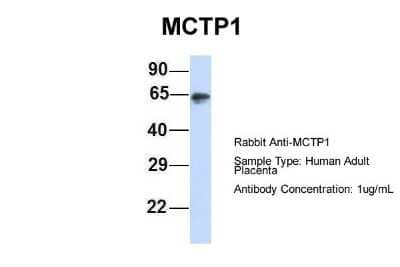 Western Blot: MCTP1 Antibody [NBP1-59908] - Human Adult Placenta, Antibody Dilution: 1.0 ug/ml.