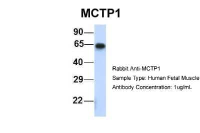 Western Blot: MCTP1 Antibody [NBP1-59908] - Human Fetal Muscle, Antibody Dilution: 1.0 ug/ml.