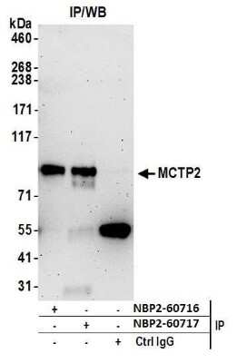 Immunoprecipitation: MCTP2 Antibody [NBP2-60717] - Detection of immunoprecipitates. Samples: Whole cell lysate (0.5 or 1.0 mg per IP reaction; 20% of IP loaded) from HeLa cells prepared using NETN lysis buffer. Antibodies: Affinity purified rabbit anti-MCTP2 antibody NBP2-60717 used for IP at 8 ul per reaction. MCTP2 was also immunoprecipitated by rabbit anti-MCTP2 antibody NBP2-60716. For blotting immunoprecipitated MCTP2, NBP2-60717 was used at 1:400. Detection: Chemiluminescence with an exposure time of 3 minutes.