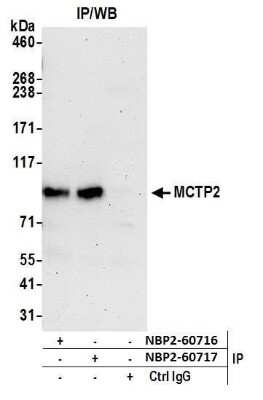 Western Blot: MCTP2 Antibody [NBP2-60716] - Detection of human MCTP2 by western blot of immunoprecipitates. Samples: Whole cell lysate (0.5 or 1.0 mg per IP reaction; 20% of IP loaded) from HeLa cells prepared using NETN lysis buffer. Antibodies: Affinity purified rabbit anti-MCTP2 antibody NBP2-60716 used for IP at 8 ul per reaction. MCTP2 was also immunoprecipitated by rabbit anti-MCTP2 antibody NBP2-60717. For blotting immunoprecipitated MCTP2, NBP2-60716 was used at 1:400. Detection: Chemiluminescence with an exposure time of 75 seconds.