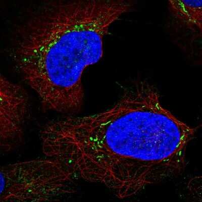 Immunocytochemistry/Immunofluorescence: MD-2 Antibody [NBP2-55669] - Staining of human cell line U-2 OS shows localization to vesicles.