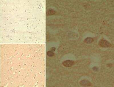 Immunohistochemistry-Paraffin: MD-2 Antibody [NB100-56655] - Analysis of MD2 in human brain tissue using an isotype control antibody (top left) and MD2 antibody (bottom left, right) at 10 ug/ml.