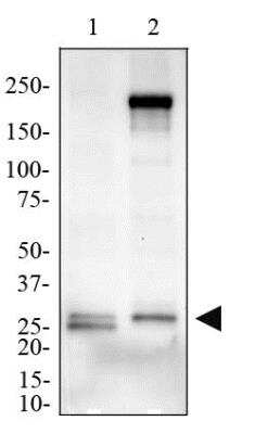 Western Blot: MD-2 Antibody [NB100-56655] - Image of anti-MD2. Total protein from human colon (lane 1) and human spleen (lane 2) was separated on a 4-15% gel by SDS-PAGE, transferred to 0.2 um PVDF membrane and blocked in 5% non-fat milk in TBST. The membrane was probed with 2 ug/ml anti-MD2 in 1% milk and detected with an anti-rabbit HRP secondary antibody using chemiluminescence.