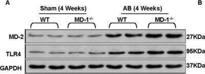 Western Blot: MD-2 Antibody [NB100-56655] - Inactivation of MEK-ERK1/2 and NF-kappaB signalling rescues the adverse effects of MD-1 deficiency on Ang II-induced myocyte hypertrophy. Representative western blot of quantitative analysis of the TLR4 and MD-2 protein levels in WT and MD-1-/- mice at 4 weeks after sham or AB surgery (n = 4). *P < 0.05 vs. WT/shams; #P < 0.05 vs. WT/AB. Image collected and cropped by CiteAb from the following publication (//www.nature.com/articles/srep41857) licensed under a CC-BY license.