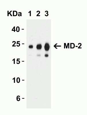 <b>Expression of Tagged Proteins Validation. </b>Western Blot: MD-2 Antibody [NBP1-77201] - Western Blot Validation with Recombinant Protein. Loading: 30 ng of human MD-2 recombinant protein per lane. Antibodies: MD-2, NBP1-77201 (Lane 1: 0.5 ug/mL, Lane 2: 1 ug/mL and Lane 3: 2 ug/mL), 1h incubation at RT  in 5% NFDM/TBST.Secondary: Goat anti-rabbit IgG HRP conjugate at 1:10000 dilution.