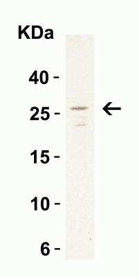 Western Blot: MD-2 Antibody [NBP1-77201] - Western Blot Validation in Daudi Cell Lysate. Loading: 15 ug of lysates per lane.Antibodies: MD-2, NBP1-77201 (1 ug/mL), 1h incubation at RT in 5% NFDM/TBST.Secondary: Goat anti-rabbit IgG HRP conjugate at 1:10000 dilution.