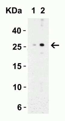 Western Blot: MD-2 Antibody [NBP1-77201] - Western Blot Validation in Mouse Spleen Tissue Lysate. Loading: 15 ug of lysates per lane. Antibodies: MD-2, NBP1-77201 (Lane 1: 0.5 ug/mL and Lane 2: 1 ug/mL), 1h incubation at RT in 5% NFDM/TBST. Secondary: Goat anti-rabbit IgG HRP conjugate at 1:10000 dilution.