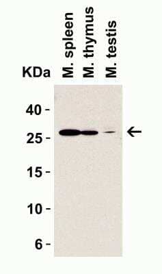 Western Blot: MD-2 Antibody [NBP1-77201] - Western Blot Validation in Mouse Tissue Lysates. Loading: 15 ug of lysates per lane.Antibodies: MD-2, NBP1-77201 (1 ug/mL), 1h incubation at RT in 5% NFDM/TBST.Secondary: Goat anti-rabbit IgG HRP conjugate at 1:10000 dilution.