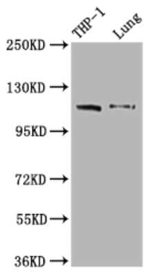 Western Blot: MDA5 Antibody (3D12) [NBP3-15166] - Positive WB detected in: THP-1 whole cell lysate, Mouse lung tissue. All lanes: MDA5 antibody at 1:2000. Secondary: Goat polyclonal to rabbit IgG at 1/50000 dilution. Predicted band size: 117, 26 KDa. Observed band size: 117 KDa.