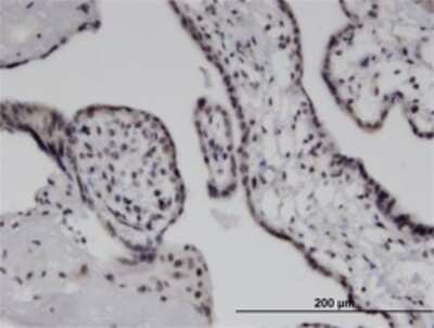 Immunohistochemistry-Paraffin: MDA5 Antibody (3F6) [H00064135-M02] - Analysis of monoclonal antibody to IFIH1 on formalin-fixed paraffin-embedded human placenta. Antibody concentration 3 ug/ml.