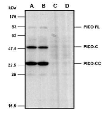 Western Blot: MDA5 Antibody (Hely-1) [NBP3-11673] - Mouse PIDD is detected in primary MEF cells using MDA5 antibody (Hely-1). Method:Cell extracts from mouse embryo fibroblasts (MEFs) either from WT (A-B) or PIDD KO cells (C-D) were separated by SDS-PAGE under reducing conditions, transferred to nitrocellulose and incubated with anti-PIDD (mouse), mAb (Lise-1) (1ug/ml). Proteins were visualized by a chemiluminescence detection system.