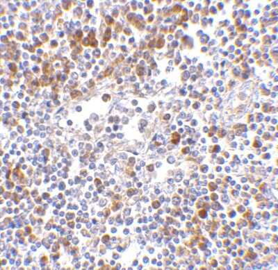 Immunohistochemistry-Paraffin: MDA5 Antibody [NBP1-76760] - Human lymph node tissue with MDA5 antibody at 5 ug/ml.