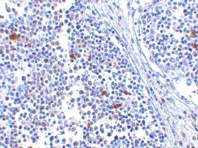 Immunohistochemistry-Paraffin: MDA5 Antibody [NBP1-76761] - Human lymph node tissue with MDA5 antibody at 5 ug/ml.