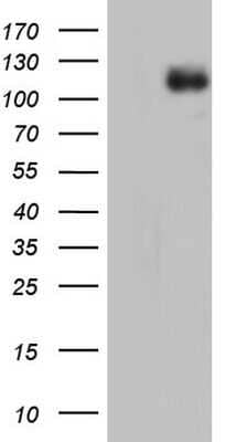 Western Blot: MDA5 Antibody (OTI8C10) - Azide and BSA Free [NBP2-72604] - Analysis of HEK293T cells were transfected with the pCMV6-ENTRY control (Left lane) or pCMV6-ENTRY MDA5.