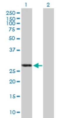 Western Blot: MDA5 Antibody [H00064135-B01P] - Analysis of IFIH1 expression in transfected 293T cell line by IFIH1 polyclonal antibody.  Lane 1: IFIH1 transfected lysate(24.31 KDa). Lane 2: Non-transfected lysate.