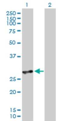 Western Blot: MDA5 Antibody [H00064135-D01P] - Analysis of IFIH1 expression in transfected 293T cell line by IFIH1 polyclonal antibody.Lane 1: IFIH1 transfected lysate(25.10 KDa).Lane 2: Non-transfected lysate.