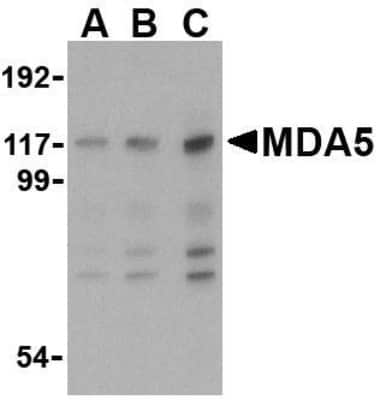 Western Blot MDA5 Antibody - BSA Free