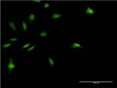 Immunocytochemistry/Immunofluorescence: MDFI Antibody (3B4) [H00004188-M07] - Analysis of monoclonal antibody to MDFI on HeLa cell. Antibody concentration 10 ug/ml