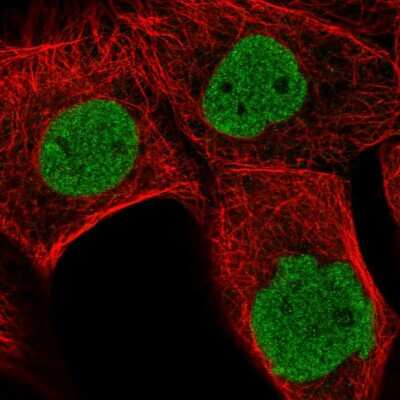 Immunocytochemistry/Immunofluorescence: MDFI Antibody [NBP2-14225] - Immunofluorescent staining of human cell line A-431 shows localization to nucleoplasm.