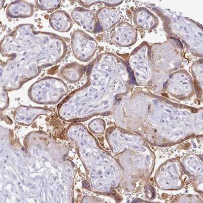 Immunohistochemistry-Paraffin: MDFI Antibody [NBP2-14225] - Staining of human placenta shows moderate cytoplasmic positivity in trophoblastic cells.