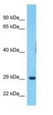 Western Blot: MDFI Antibody [NBP3-09275] - Western blot analysis of MDFI in RPMI-8226 Whole Cell lysates. Antibody dilution at 1.0ug/ml