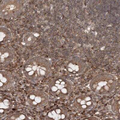 Immunohistochemistry-Paraffin: MDFIC Antibody [NBP1-93698] - Staining of human appendix shows moderate cytoplasmic positivity in glandular cells and lymphoid tissue.
