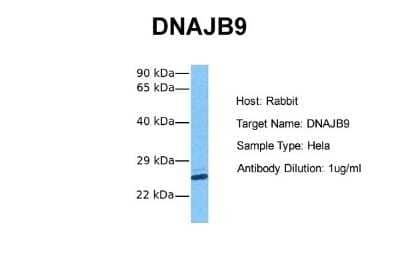 Western Blot: MDG1 Antibody [NBP1-69578] - Sample Tissue: Human Hela Antibody Dilution: 1.0 ug/ml