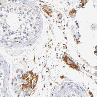 Immunohistochemistry-Paraffin: MDGA2 Antibody [NBP1-93532] - Staining of human testis shows strong cytoplasmic positivity in Leydig cells.