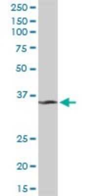 Western Blot: MDH1 Antibody [H00004190-D01P] - Analysis of MDH1 expression in human spleen.