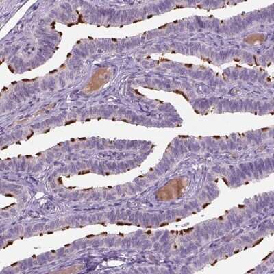 Immunohistochemistry MDH1B Antibody - BSA Free