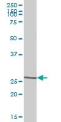 Western Blot: MDL-1/CLEC5A Antibody [H00023601-B01P] - Analysis of CLEC5A expression in human liver.