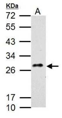 Western Blot: MDL-1/CLEC5A Antibody [NBP2-43607] - Analysis of 30 ug whole cell lysate. A: K562 12% SDS PAGE diluted at 1:1000.