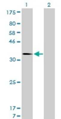 Western Blot: MDM2/HDM2 Antibody (1A7) [H00004193-M01] - Analysis of MDM2 expression in transfected 293T cell line by MDM2 monoclonal antibody (M01), clone 1A7.Lane 1: MDM2 transfected lysate(55.2 KDa).Lane 2: Non-transfected lysate.